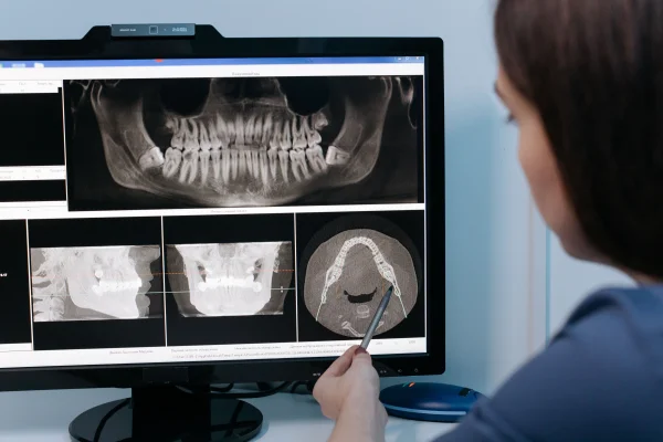 Pantomogram — co pokazuje i po co się go robi