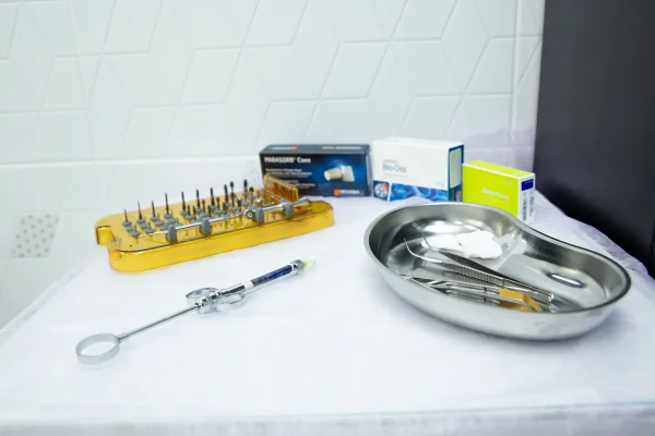 Przeciwwskazania do implantów — kto nie może mieć implantu