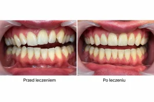 April Stomatologia